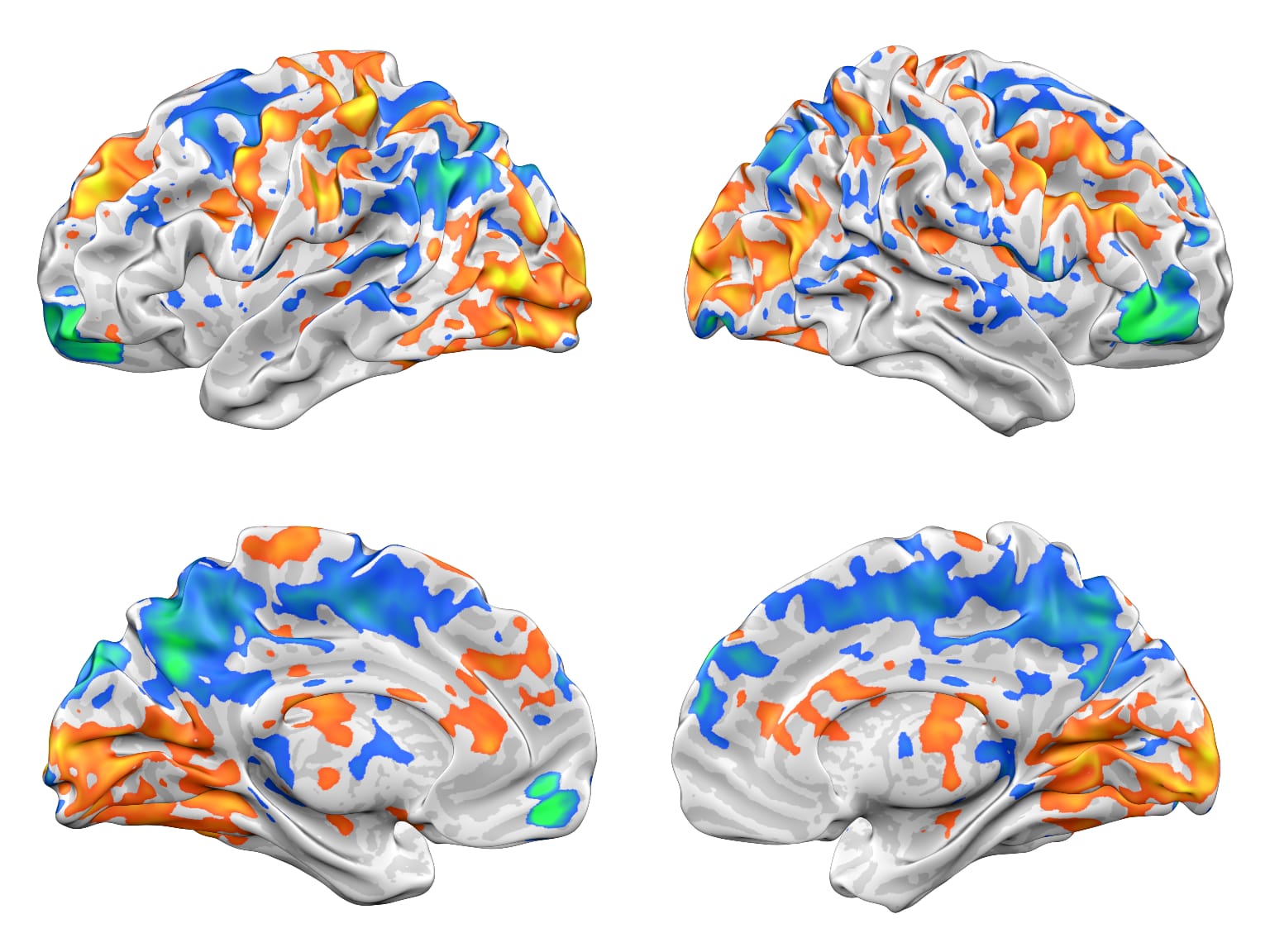 Meta-analysis revealing brain regions and networks